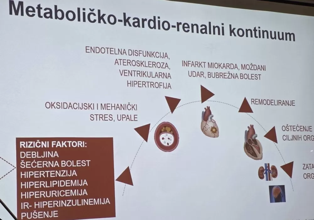 Ugledni liječnici u Slavonskom Brodu o prevenciji kardiovaskularnih rizika i šećernih bolesti